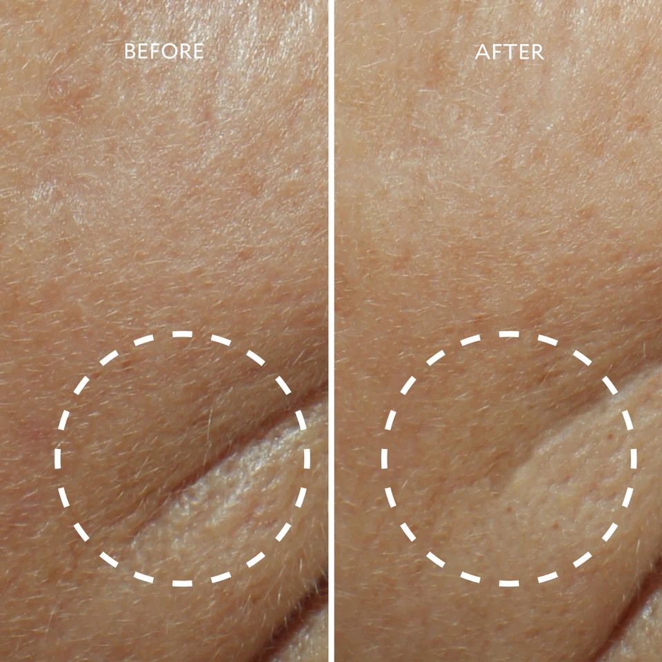 Defi Lift™ Active Firming Serum