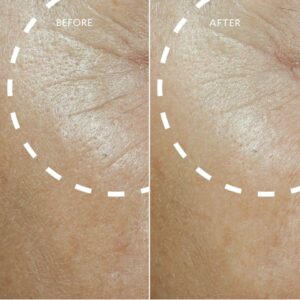 Defi Lift™ Active Firming Serum