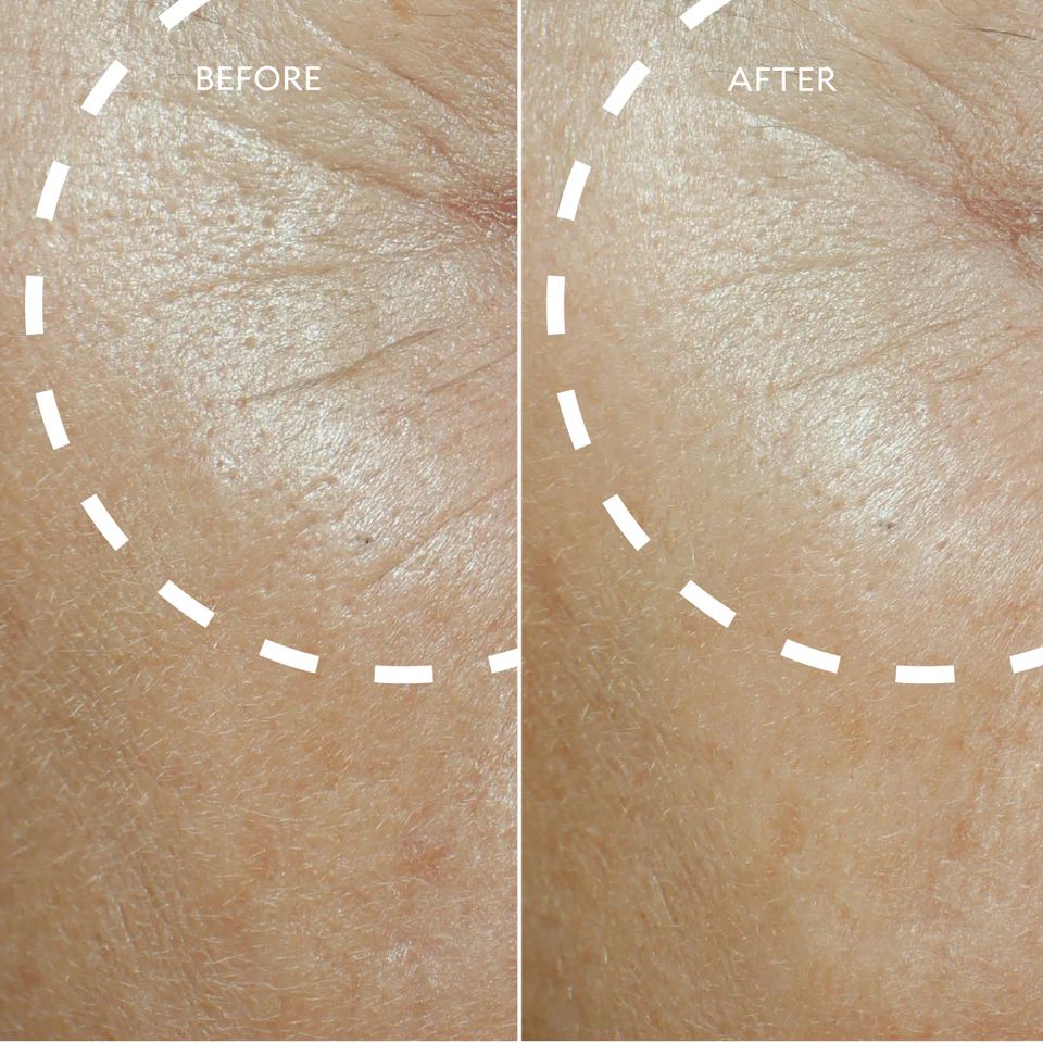 Defi Lift™ Active Firming Serum
