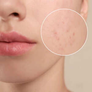 Uus toode Nimue’lt – Plump & Firming Contour Gel