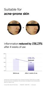 ISNTREE Onion Newpair Spot Patch Skin Fit