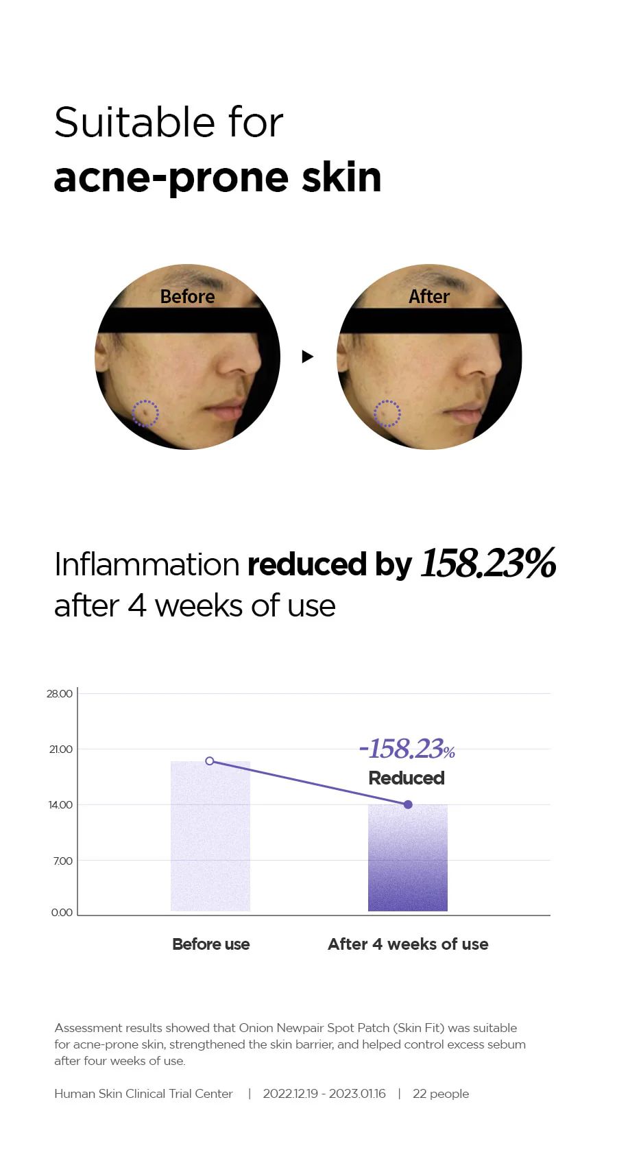 ISNTREE Onion Newpair Spot Patch Skin Fit