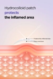 ISNTREE Onion Newpair Spot Patch Skin Fit