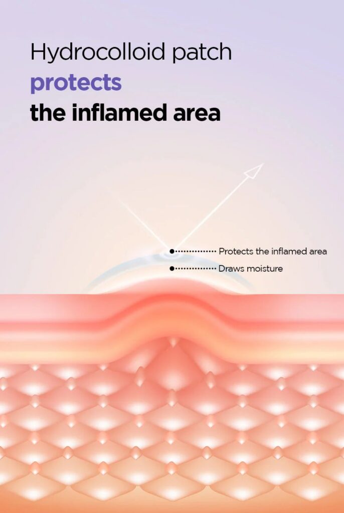 ISNTREE Onion Newpair Spot Patch Skin Fit