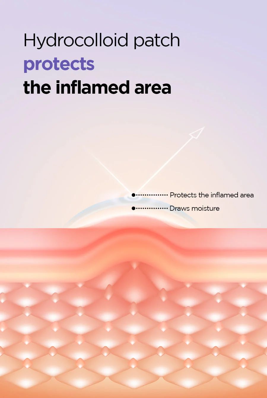 ISNTREE Onion Newpair Spot Patch Skin Fit